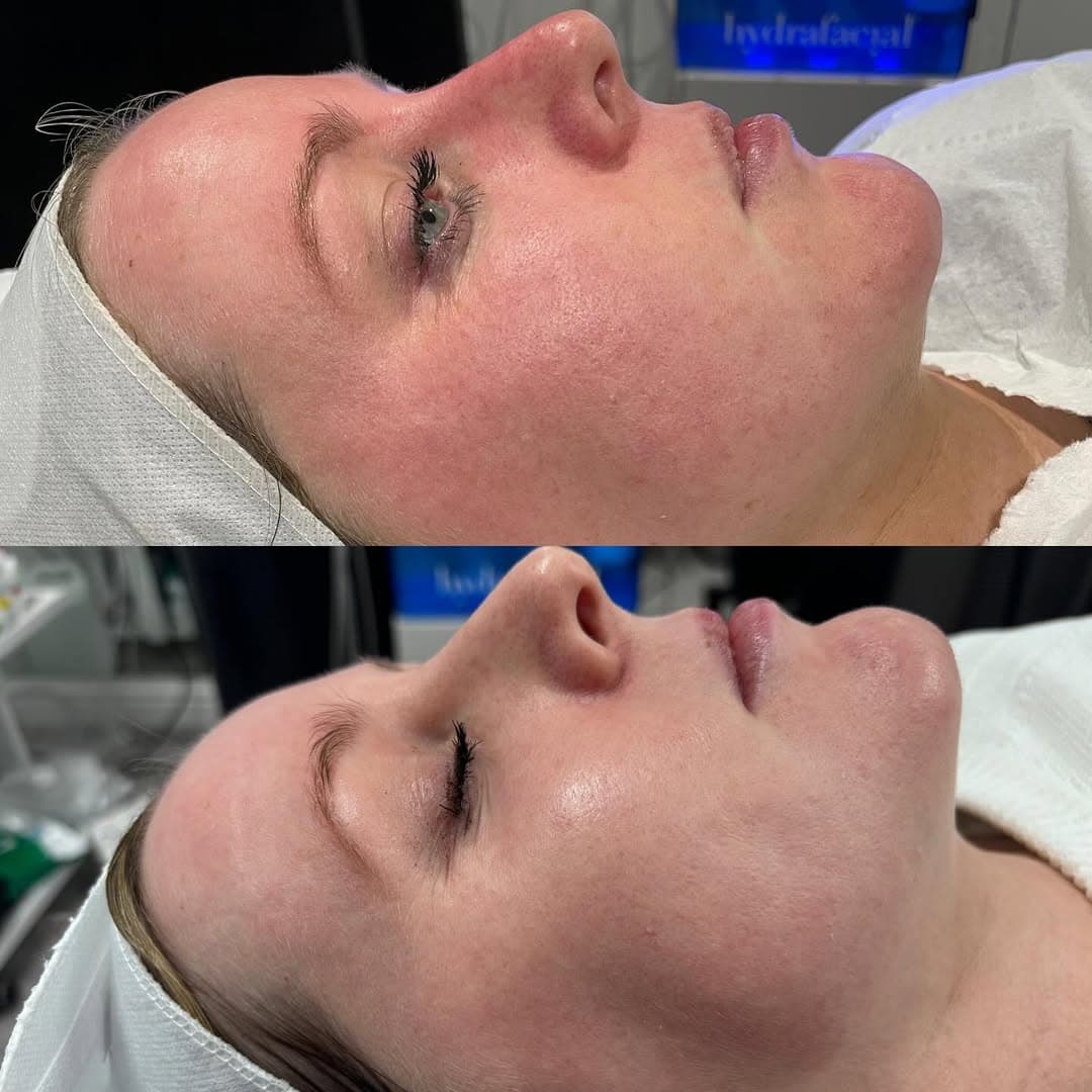 Skin Health & Hydration