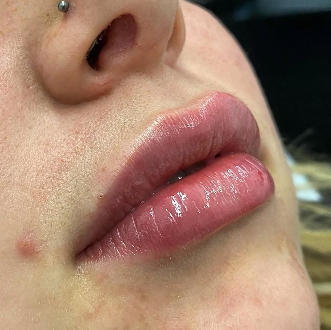 Instagram post from MCM Aesthetics & Dermatology