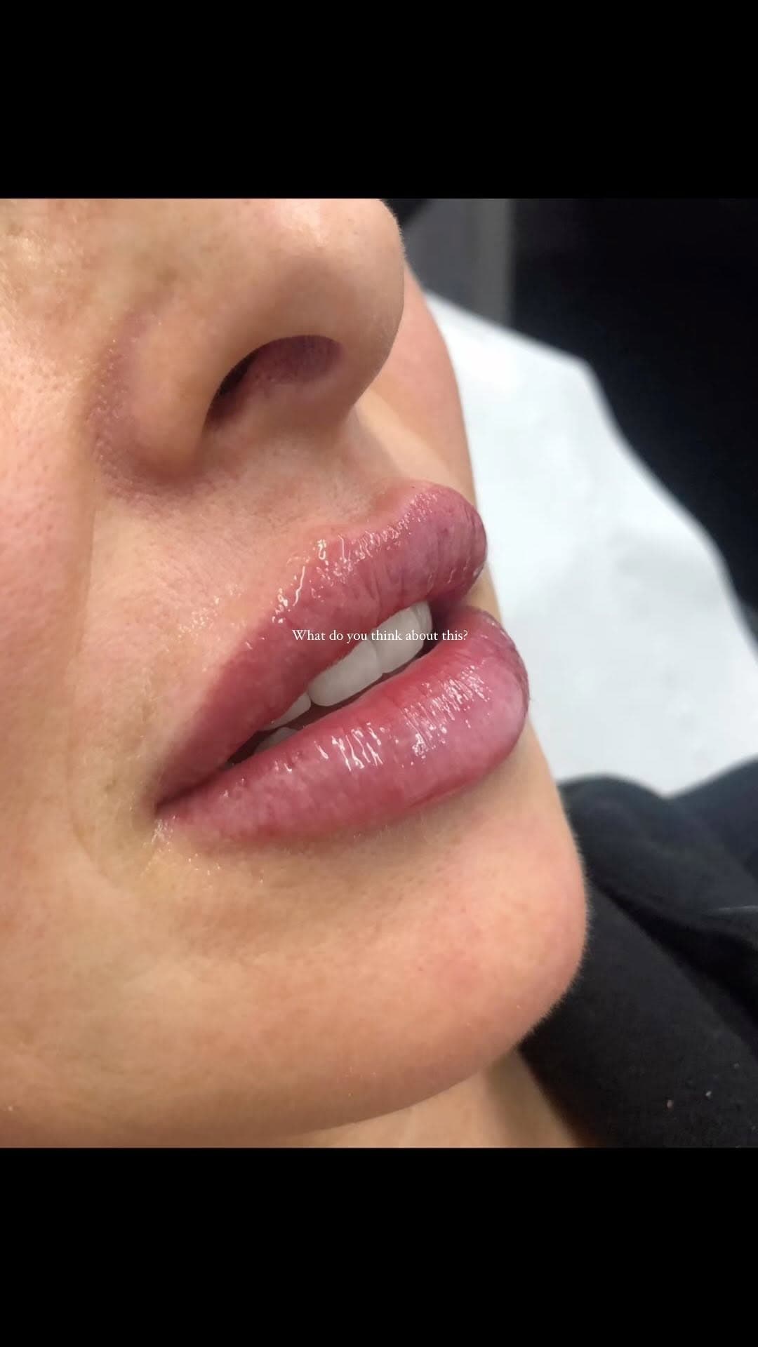 Instagram post from MCM Aesthetics & Dermatology
