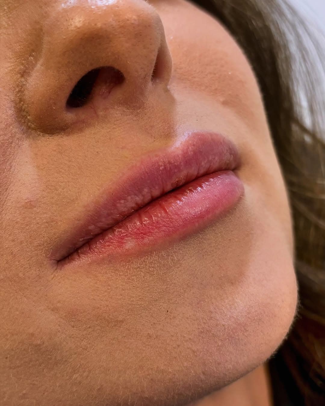 Instagram post from MCM Aesthetics & Dermatology
