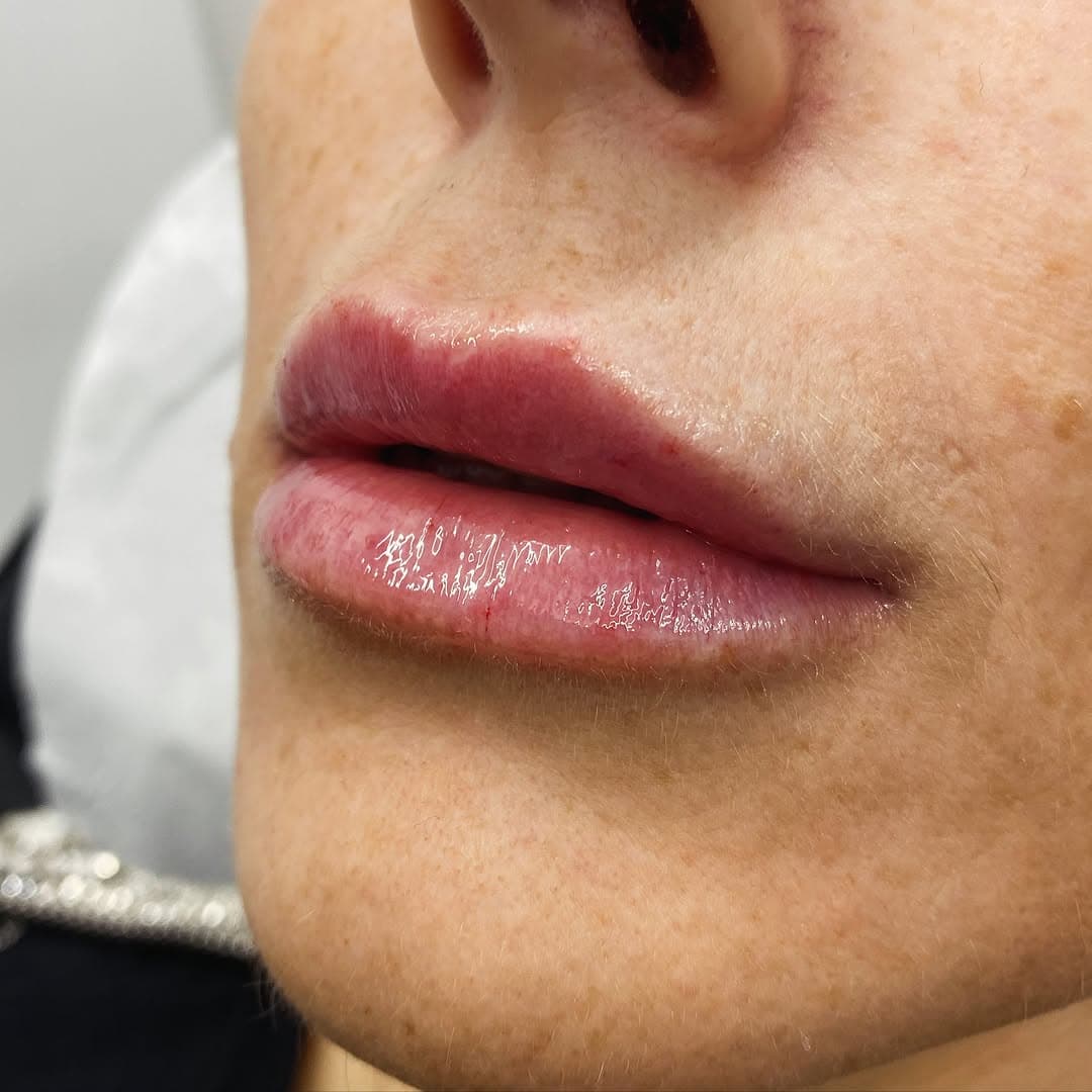 Instagram post from MCM Aesthetics & Dermatology