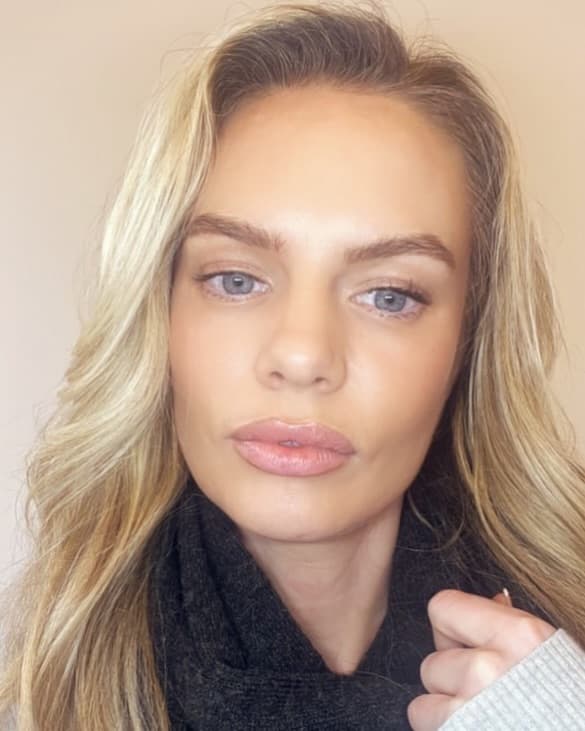 A patient of MCM Aesthetics & Dermatology