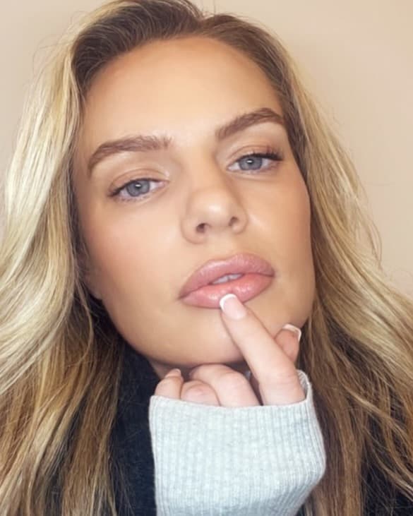 A patient of MCM Aesthetics & Dermatology